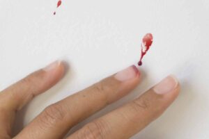 解決指甲斷掉流血緊急情況：有效處理技巧一次搞定！